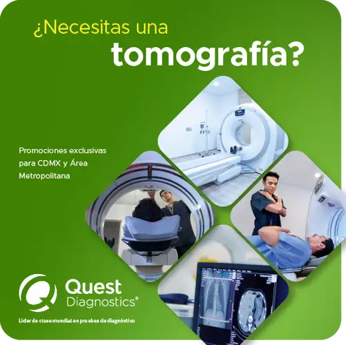 Promoción en Tomografía para Ciudad de México 