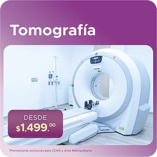 Promoción en Tomografía para Ciudad de México 
