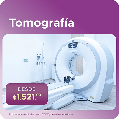 Promoción en Tomografía para Ciudad de México 